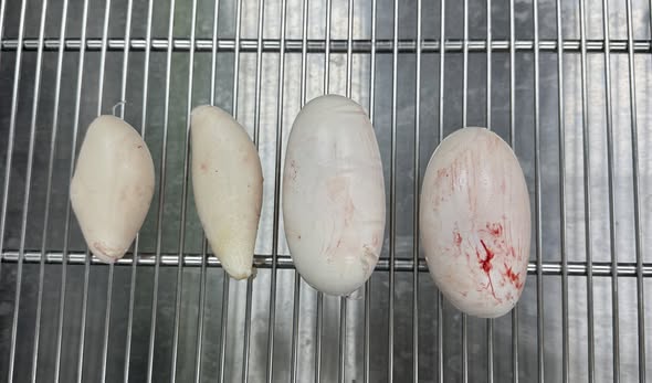 特寵內視鏡探查輸卵管沾黏